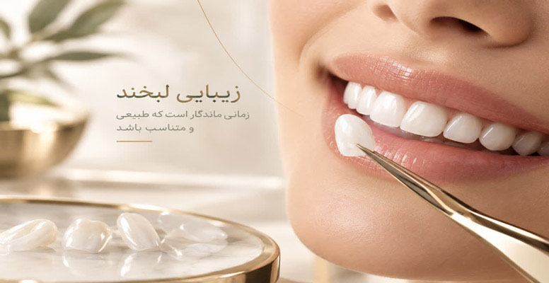 لمینت سرامیکی - لبخندی که همیشه آرزویش را داشتید